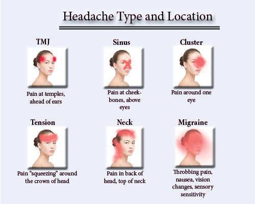 headache pain areas